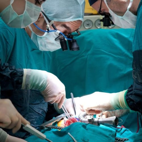 laproscopic surgeries